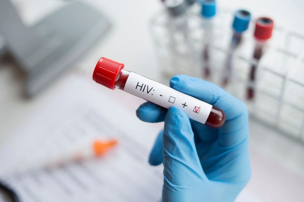Red Somos presenta observatorio con datos clave sobre la prevención del VIH en Colombia. | Foto: Imagen de Referencia / Canva.