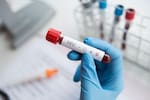 Red Somos presenta observatorio con datos clave sobre la prevención del VIH en Colombia