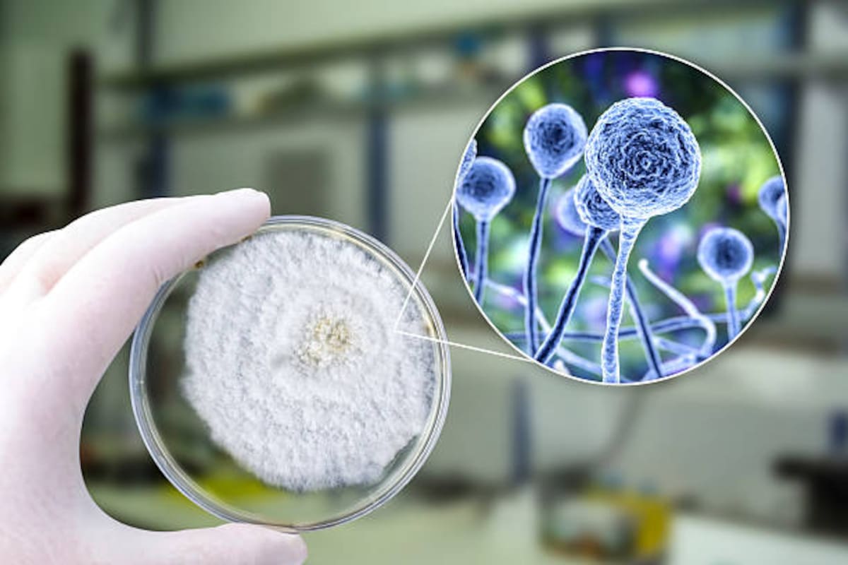 Las autoridades europeas investigan cómo se produjo la infección por Shamonda en un paciente con inmunodepresión severa.