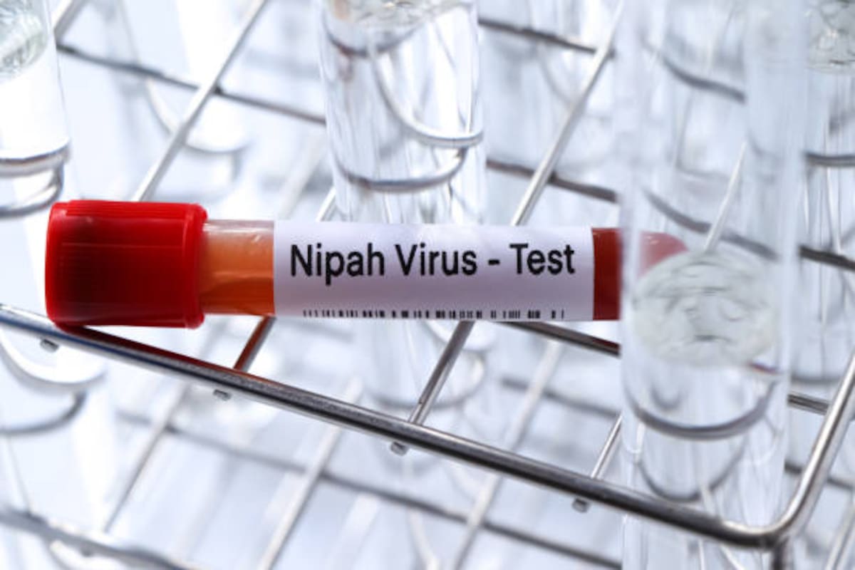 Los dos casos de infección por el virus Nipah notificados por la India en Bengala Occidental son los terceros en este estado desde que se identificó el virus por primera vez en 1998.