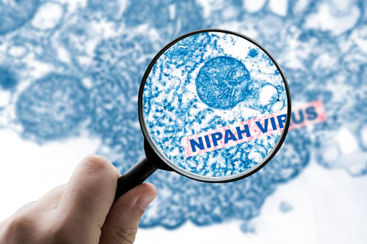 Virus Nipah: por qué hay aeropuertos en alerta y qué tan grave es.