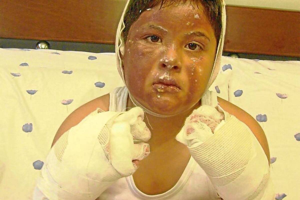 Santiago Albarracín Caballero fue otra víctima de las aparentemente inofensivas bombas. (Foto: Suministrada/VANGUARDIA LIBERAL)
