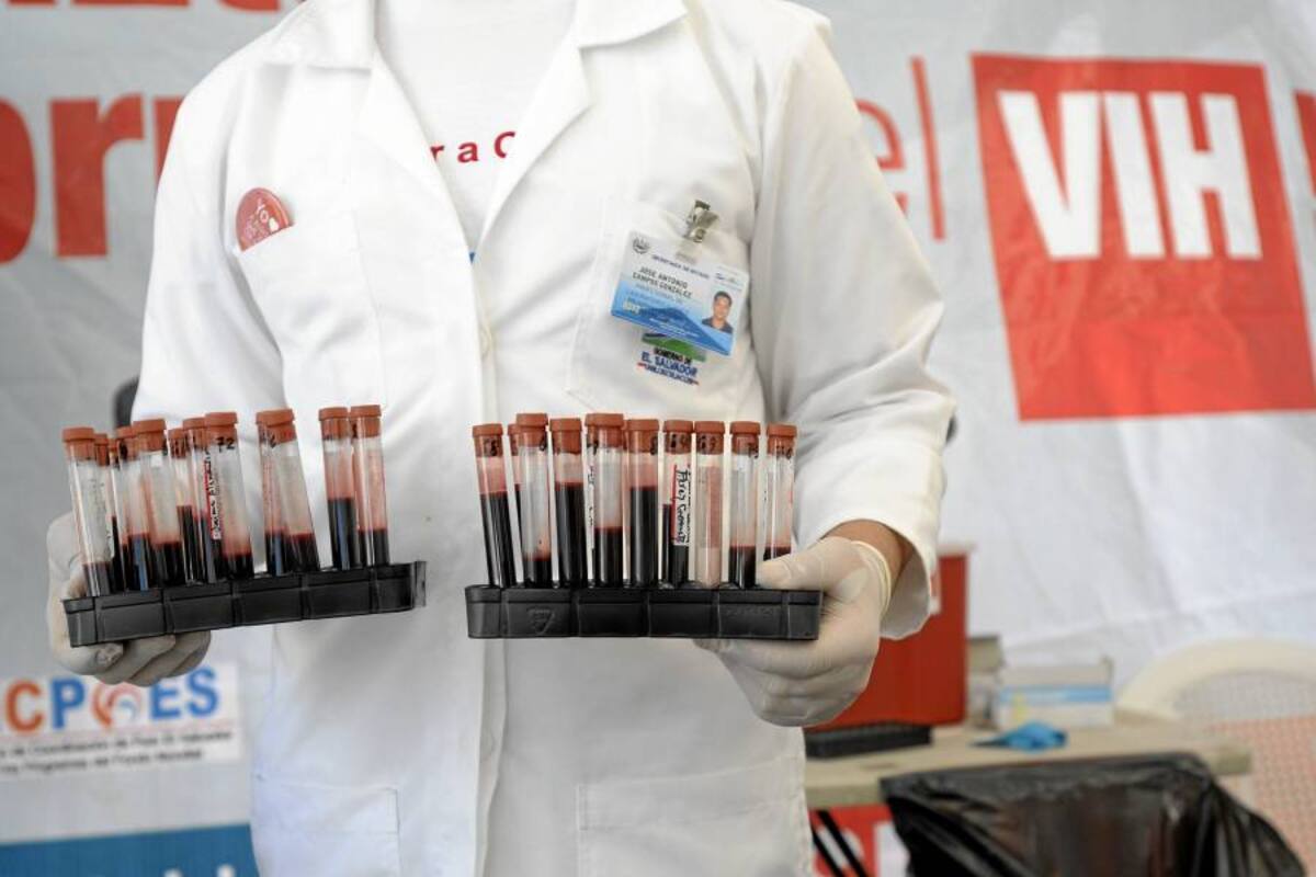 Fin de pandemia de sida está cerca, afirma eminente virólogo estadounidense (Foto: Archivo/VANGUARDIA LIBERAL)