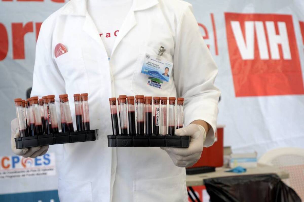 Epidemia del sida podría finalizar en 2030 (Foto: Archivo/VANGUARDIA LIBERAL)