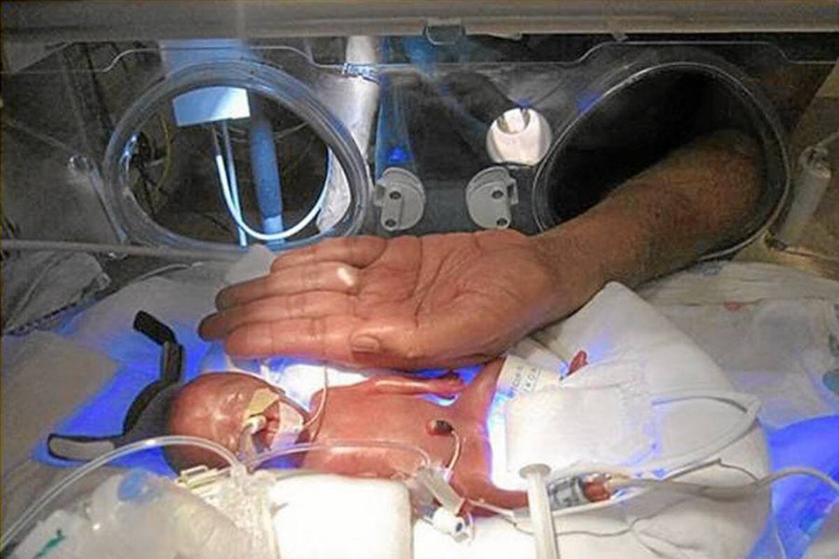 Tercer bebé más pequeño del mundo que sobrevive deja el hospital en EU (Foto: Tomado de internet/ VANGUARDIA LIBERAL)