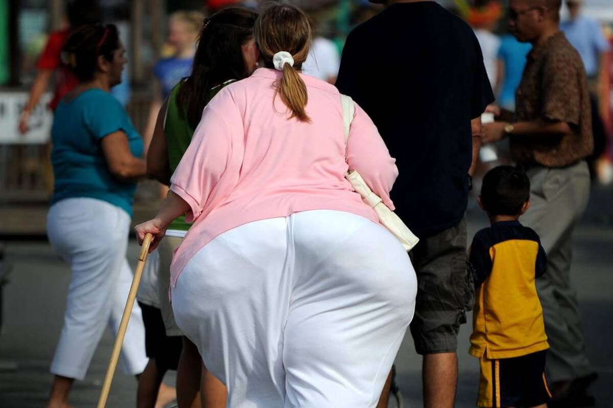 Hambre y obesidad el doble riesgo de América Latina según la ONU (Foto: Archivo/VANGUARDIA LIBERAL)