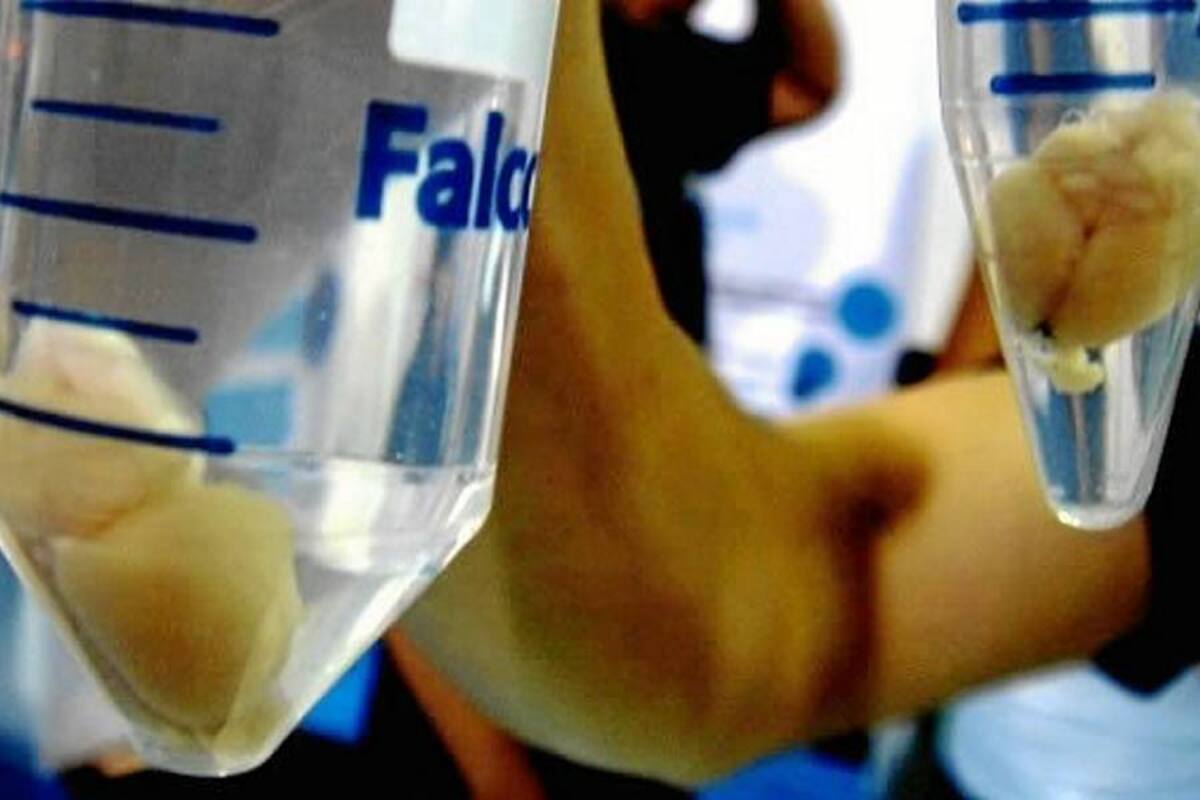 Hallazgos sobre los astrocitos abren nuevas perspectivas ante el alzhéimer (Foto: Tomada de internet/VANGUARDIA LIBERAL)