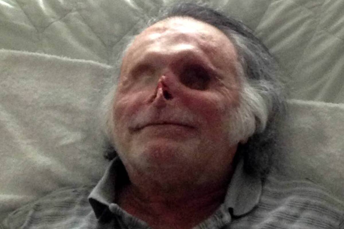 Así luce en la actualidad víctima de ‘caníbal de Miami’ (Foto: EFE / VANGUARDIA LIBERAL)