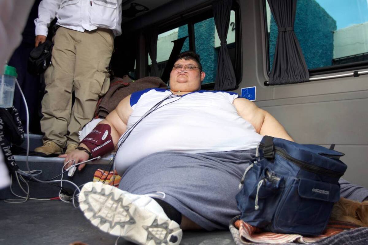 El hombre más obeso del mundo inicia tratamiento para bajar de peso en México (Foto: EFE /VANGUARDIA LIBERAL)