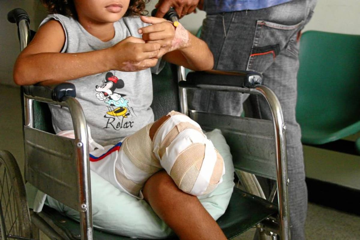 A seis horas de un médico, con una pierna destrozada por una mina (Foto: Hernando Galeano/ VANGUARDIA LIBERAL)
