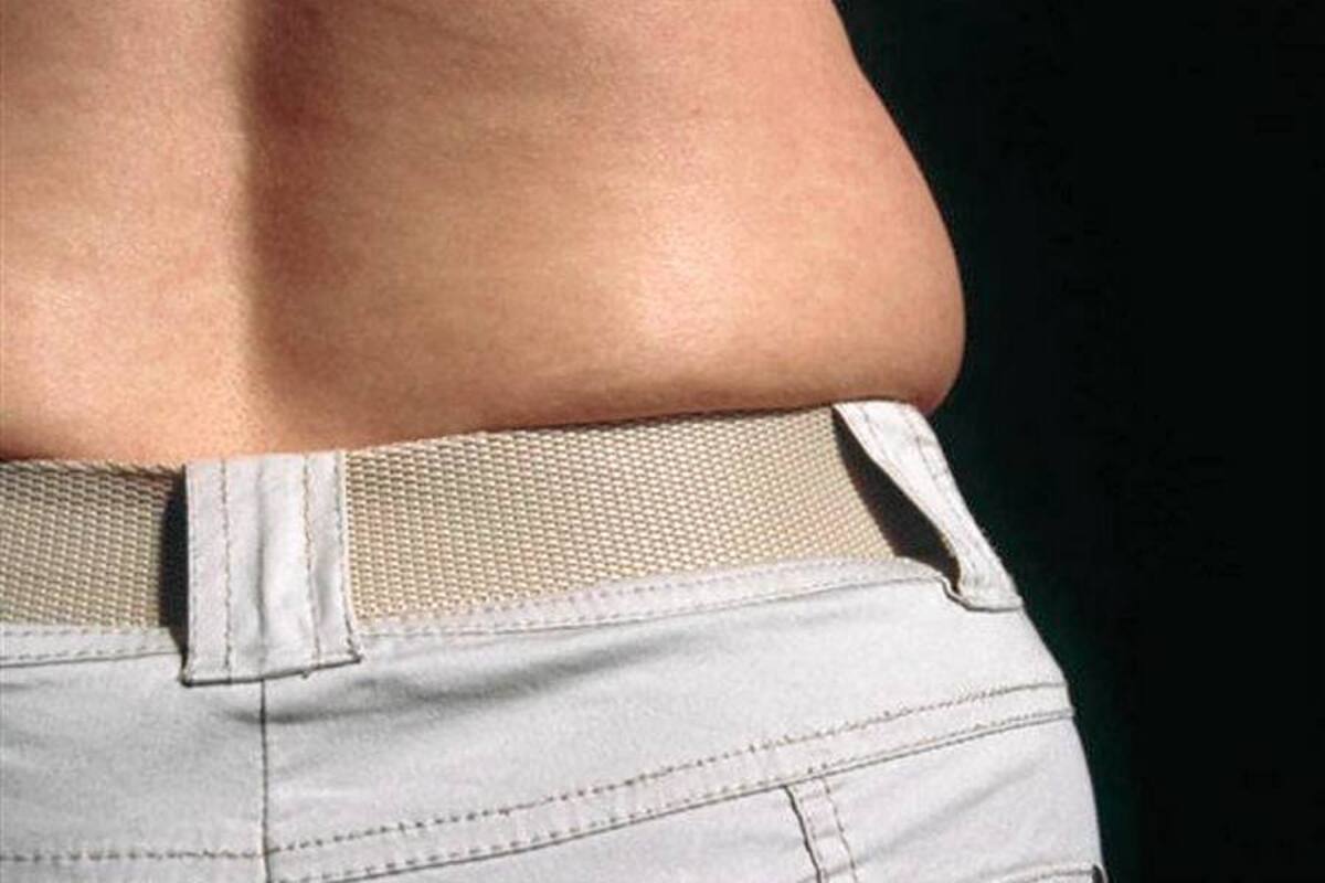 Usar la ropa ajustada te puede traer problemas de salud (Foto: TOMADA DE INTERNET )