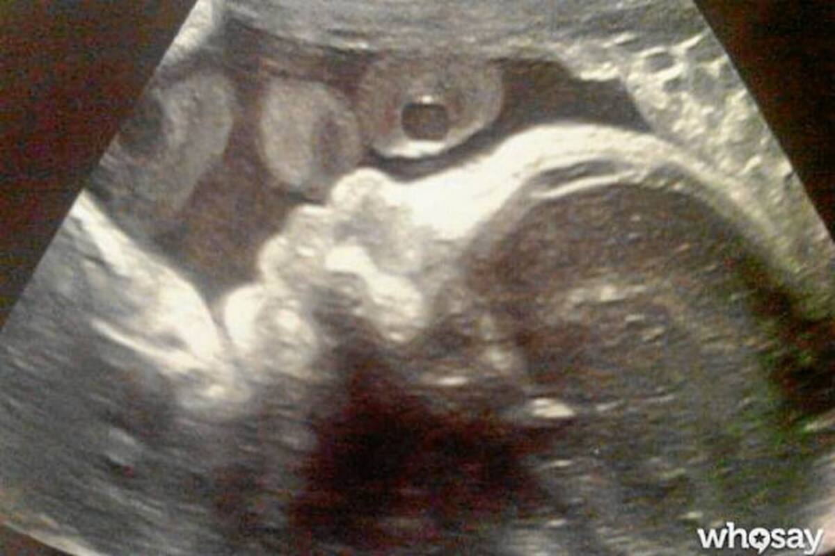 Piqué comparte una ecografía de su hijo (Foto: Foto Whosey)