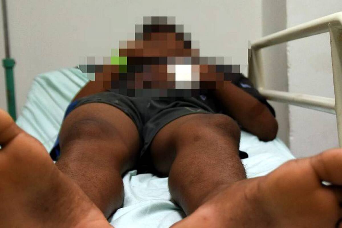 Niño se salvó en Santander tras ser mordido por peligrosa serpiente (Foto: Edgar Pernett S./VANGUARDIA LIBERAL)