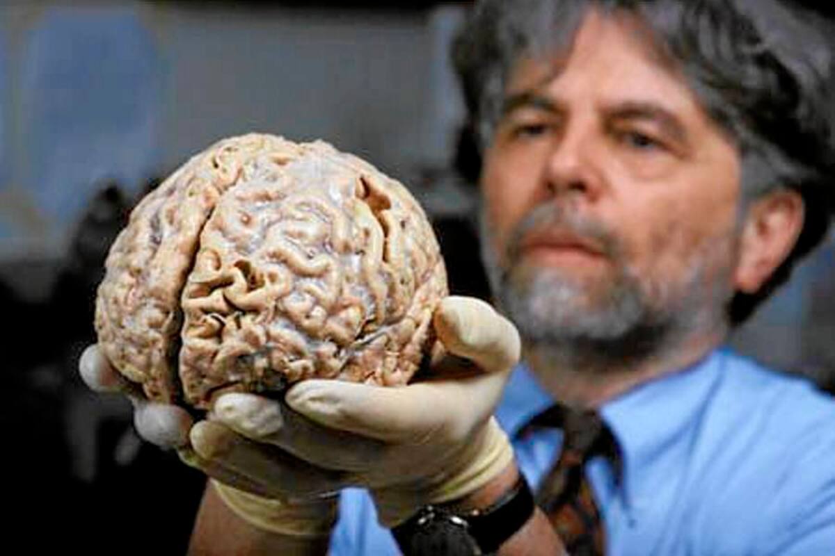 ¿Fumar daña el cerebro? (Foto: Tomada de internet/VanguardiaLiberal)
