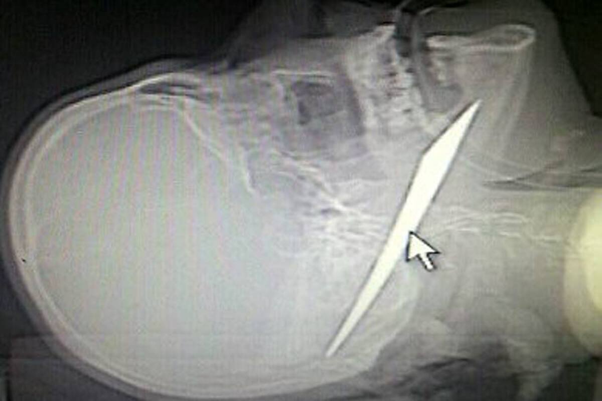 Murió hombre acuchillado por su hijastro (Foto: Archivo/VANGUARDIA LIBERAL)