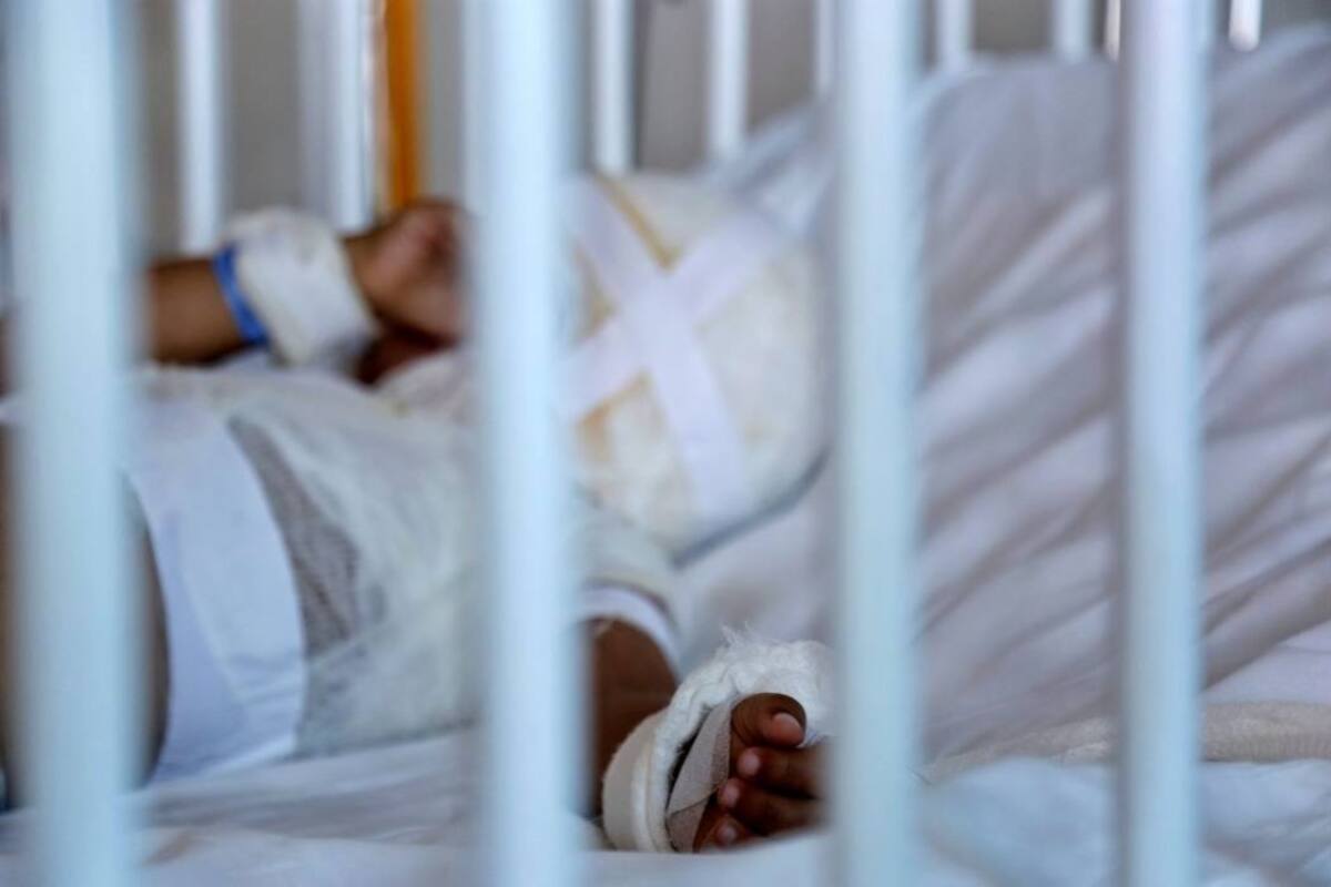 Aumenta a 39 el número de lesionados con pólvora en lo que va de diciembre (Foto: Colprensa /Vanguardia Liberal)