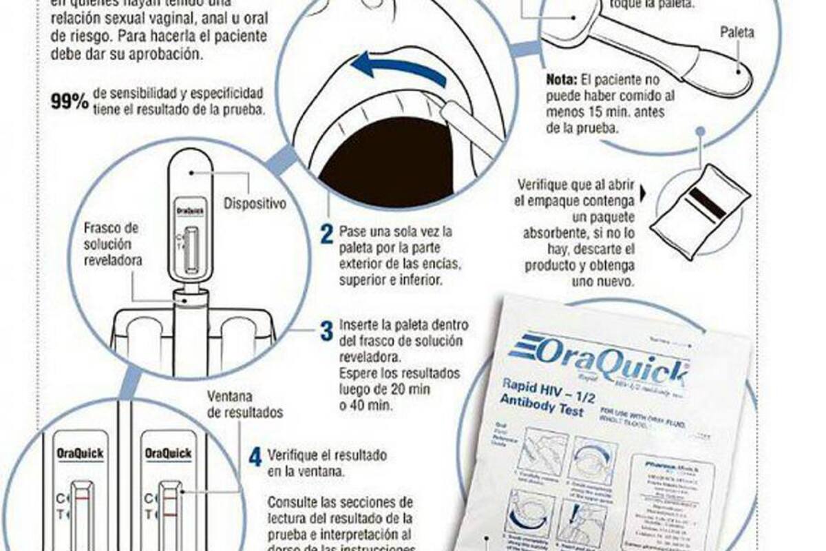 VIH se detecta en la saliva (Foto: Archivo/VANGUARDIA LIBERAL)