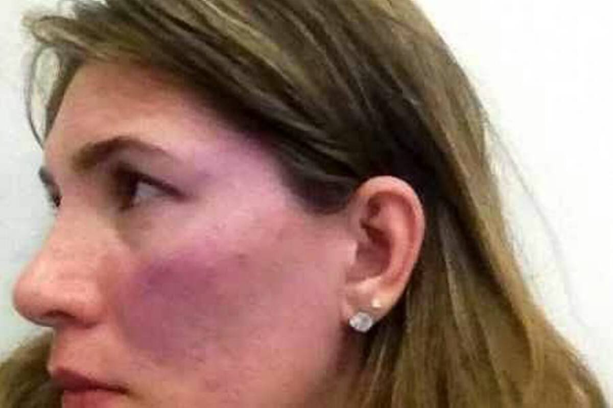 Congresista fue denunciado por golpear a su exesposa (Foto: Colprensa / VANGUARDIA LIBERAL)