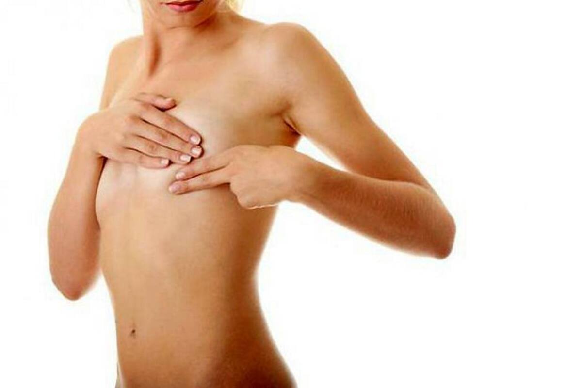 Diseñan brassier electrónico para detección de cáncer de seno (Foto: Colprensa / VANGUARDIA LIBERAL)