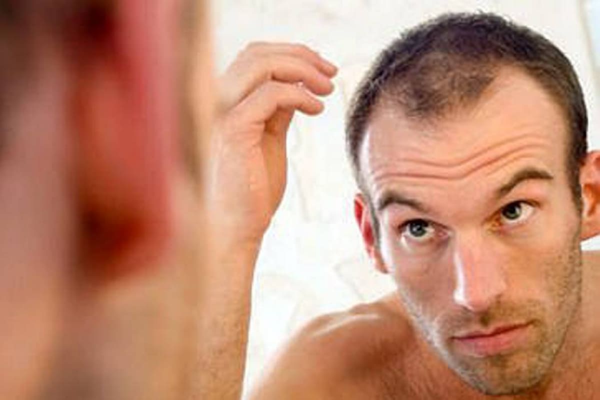 ¿Sabe por qué los hombres se quedan calvos? (Foto: Tomado de www.manualdelhombre.com/VANGUARDIA LIBERAL)