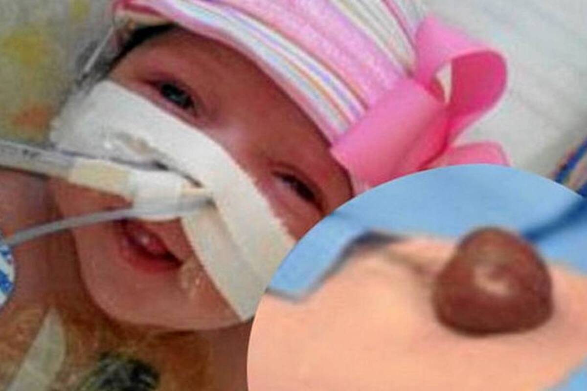 Bebé nació con el corazón fuera del cuerpo (Foto: Tomado de Internet/ VANGUARDIA LIBERAL)