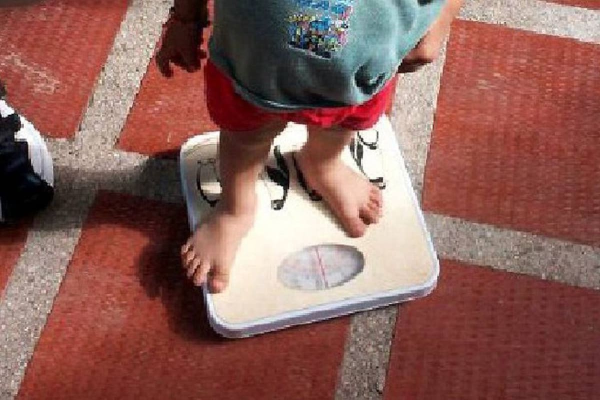 Para poder establecer cuándo un niño se encuentra desnutrido, es necesario saber cuánto pesa y cuánto mide. (Foto: Archivo / VANGUARDIA LIBERAL)