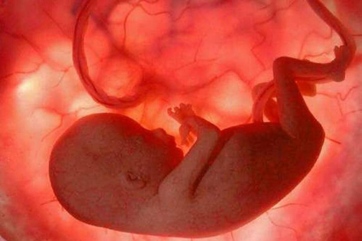 Pruebas de laboratorio a fetos previenen afecciones y reducen su mortalidad (Foto: Tomada de internet/VANGUARDIA LIBERAL)