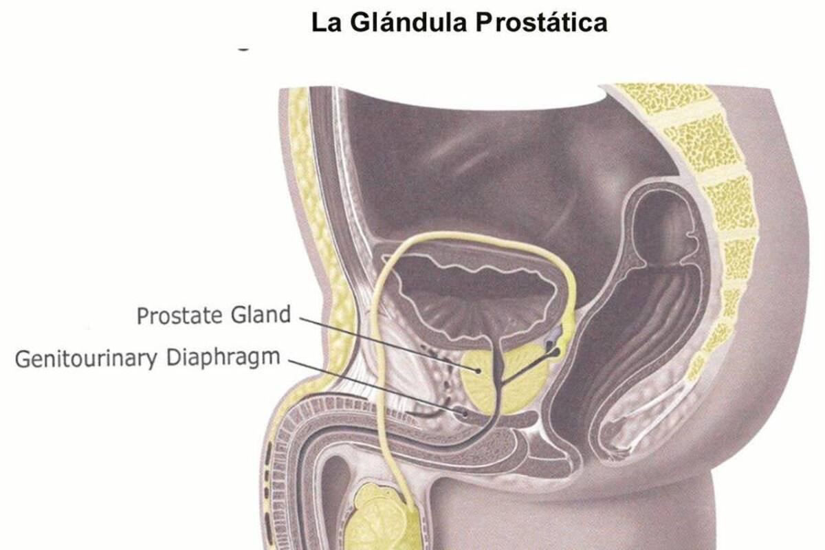 Un estudio pone en duda el test de PSA para detectar el cáncer de próstata (Foto: Archivo/ VANGUARDIA LIBERAL)