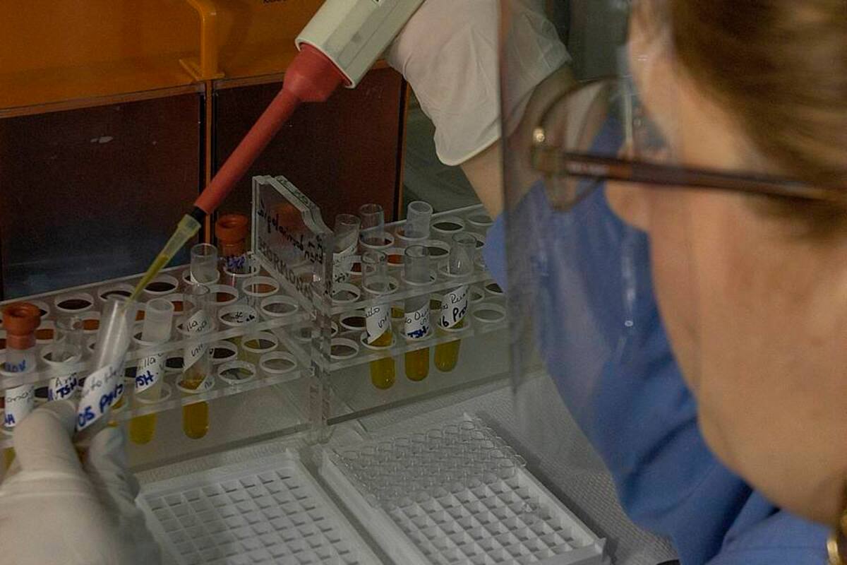Tras probarlo en ratones, los investigadores repitieron la experiencia en un donante voluntario. (Foto: Archivo/VANGUARDIA LIBERAL)