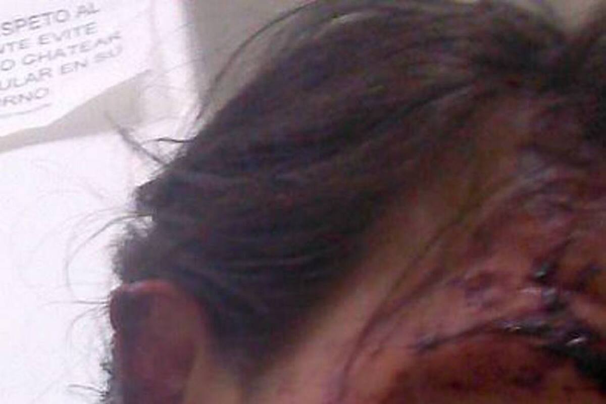 Denuncian agresión contra mujer en Santander (Foto: Suministrada/VANGUARDIA LIBERAL)