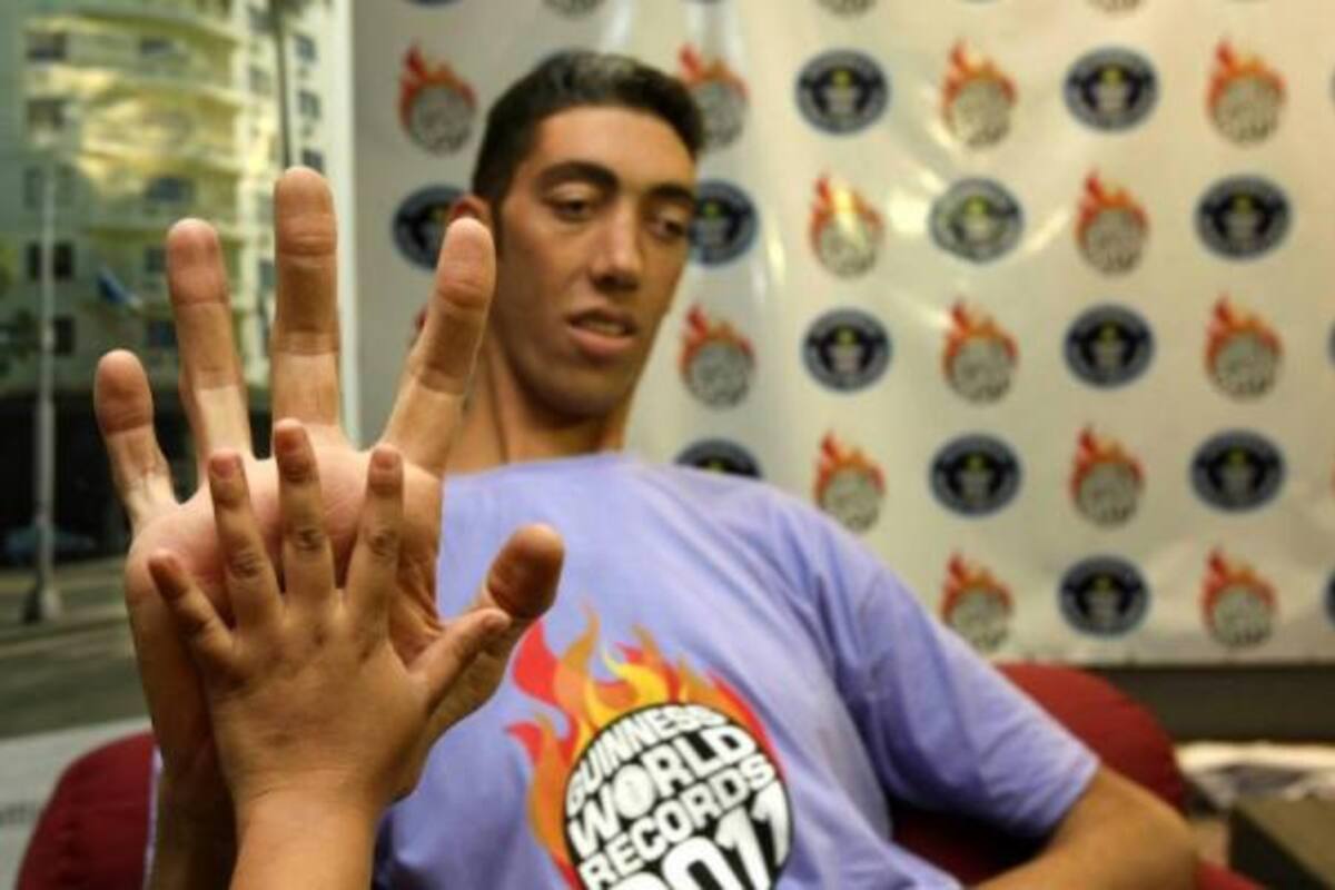 (Foto: Efe/ VANGUARDIA LIBERAL)