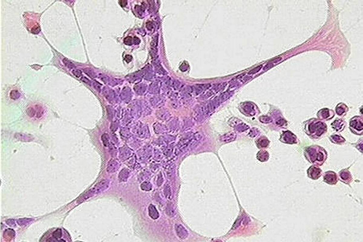 El virus del herpes simple activa la respuesta inmune en vez de bloquearla (Foto: Tomada de internet)