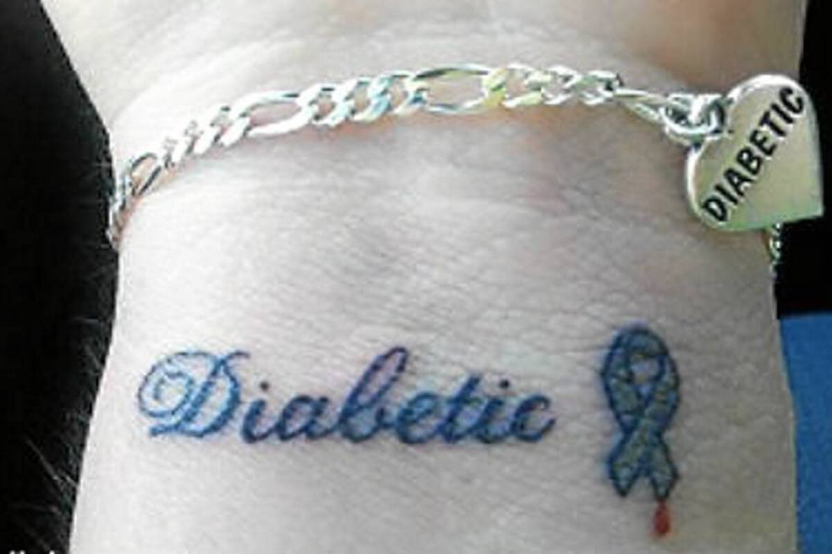 Aumenta la popularidad de los tatuajes para informar de condiciones médicas (Foto: Tomada de internet/VANGUARDIA LIBERAL)