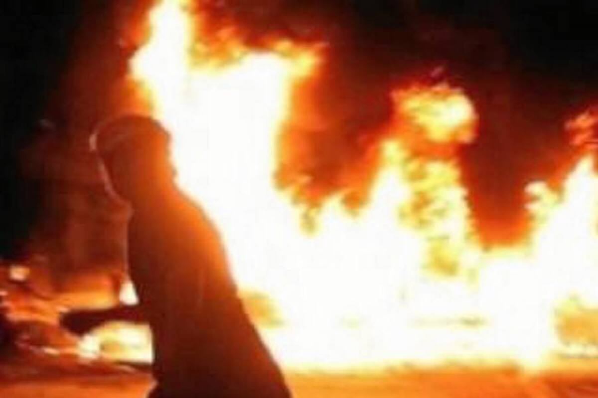 Hombre machetea y le prende fuego a su exnovia en Cartagena (Foto: Tomada de internet/VANGUARDIA.COM)