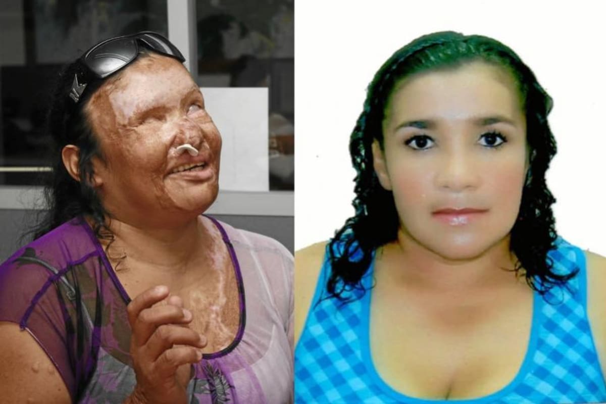 Nubia Patricia Carreño Barrera (Foto: Archivo/VANGUARDIA LIBERAL)