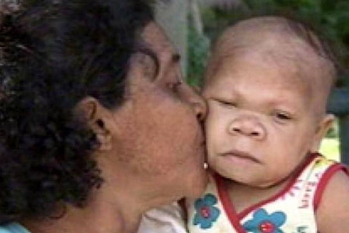 Mujer de 30 años vive en el cuerpo de una bebé de 6 meses (Foto: Tomada de Internet/ VANGUARDIA LIBERAL)