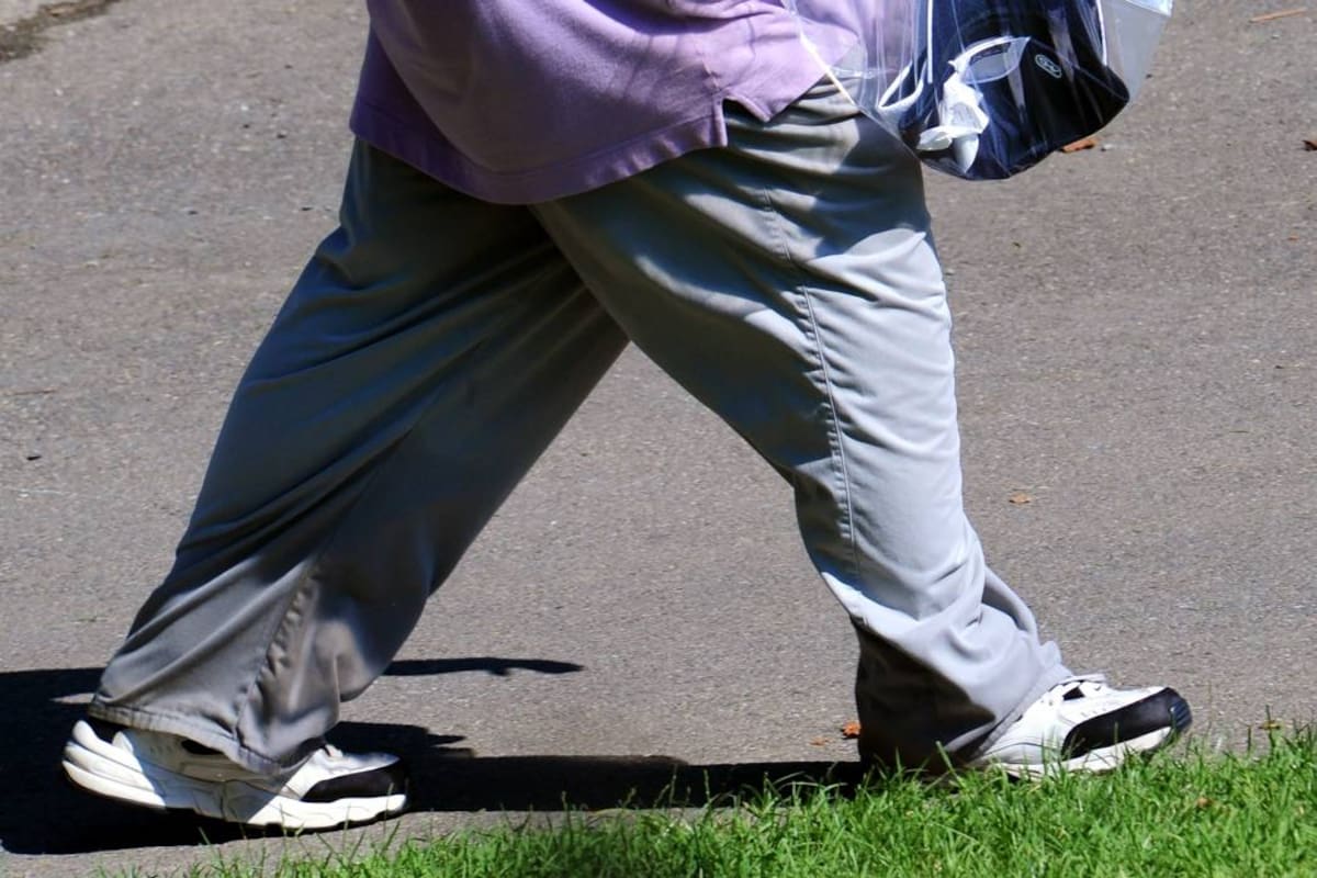 Científicos proponen un nuevo tipo de cirugía para combatir la obesidad (Foto: Archivo/ VANGUARDIA LIBERAL)