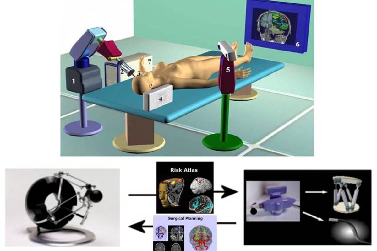 Científicos europeos ensayan un robot para operar cerebro con más precisión (Foto: Tomada de Internet/ VANGUARDIA LIBERAL)