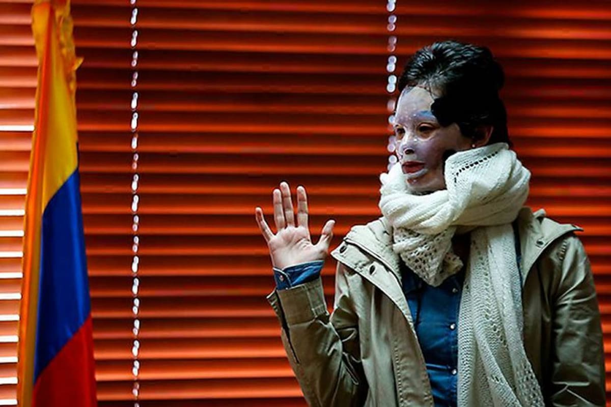 Proceso de recuperación de Natalia Ponce de León va en la mitad (Foto: Colprensa, El País/ VANGUARDIA LIBERAL)