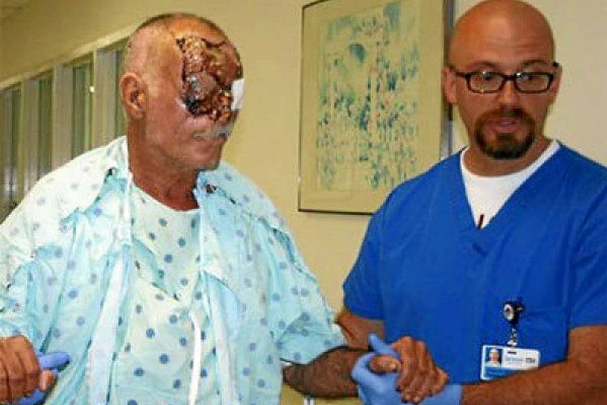 La víctima del "caníbal" de Miami revela los detalles del ataque (Foto: Tomado de Internet/VANGUARDIA LIBERAL)