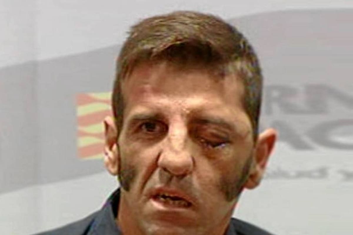 El torero que perdió un ojo por una cornada vuelve al ruedo 5 meses después (Foto: Tomada de internet/VANGUARDIA LIBERAL)