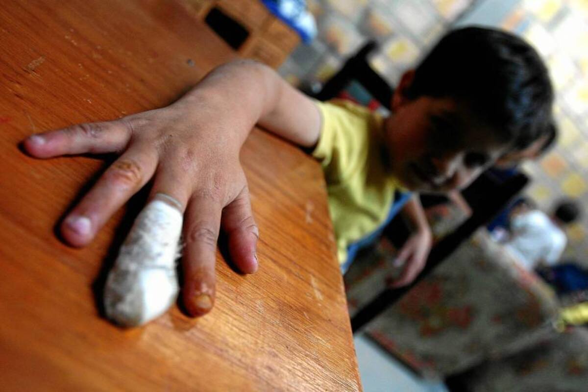 ¿Por qué diciembre siempre se empaña con niños quemados? (Foto: Archivo/VANGUARDIA LIBERAL)