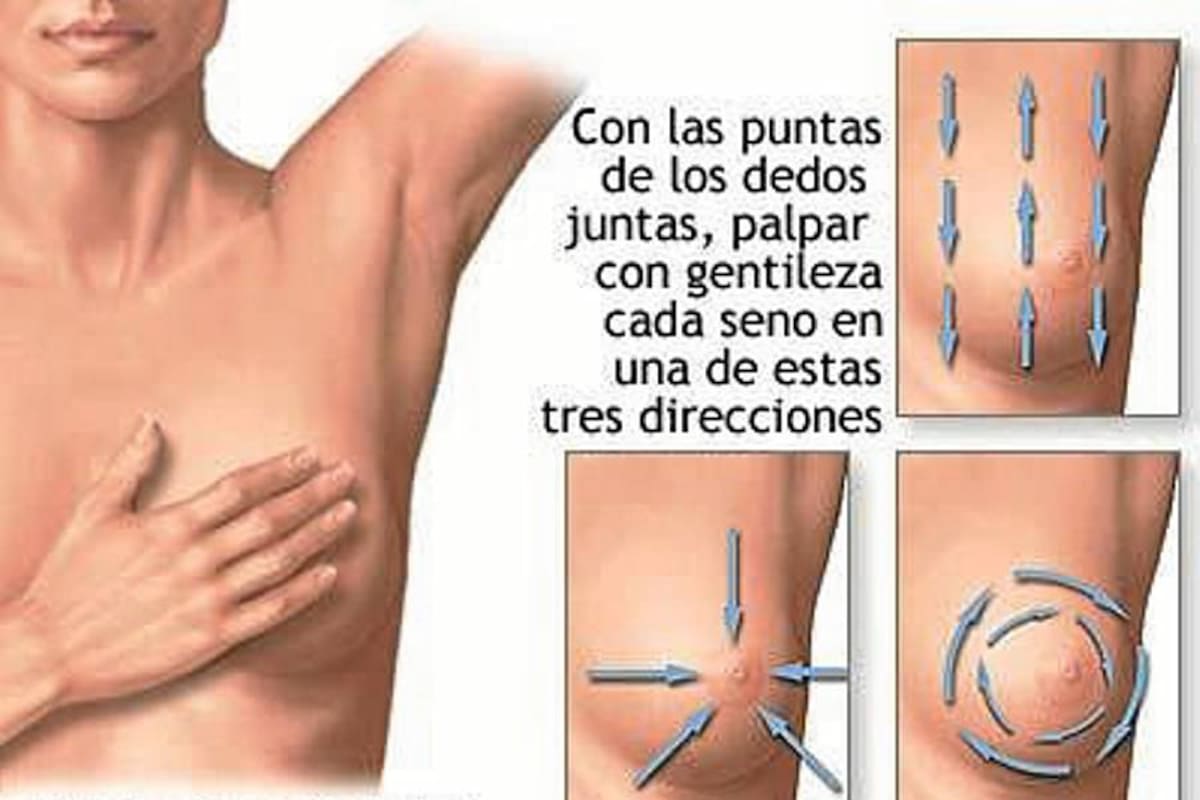 El cáncer de seno podría detectarse a tiempo en el 72% de los casos (Foto: Archivo/VANGUARDIA LIBERAL)