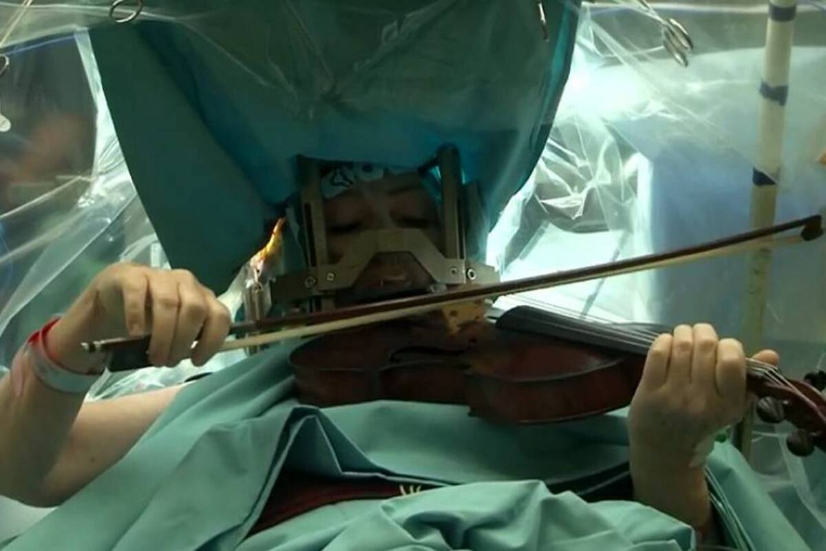 Mujer toca violín mientras le operan el cerebro (Foto: TOMADO DE YOUTUBE.COM/VANGUARDIA LIBERAL)