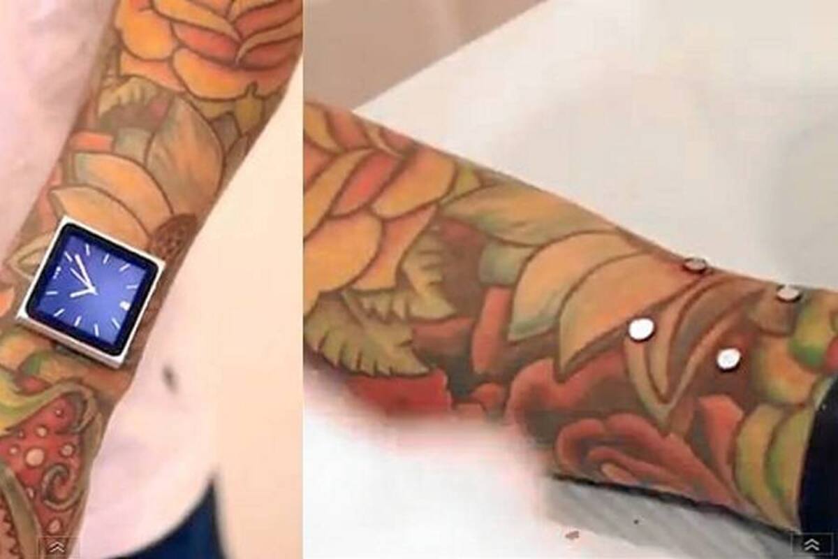 Fanático de Apple muestra como se injertó imanes en su brazo para portar su iPod