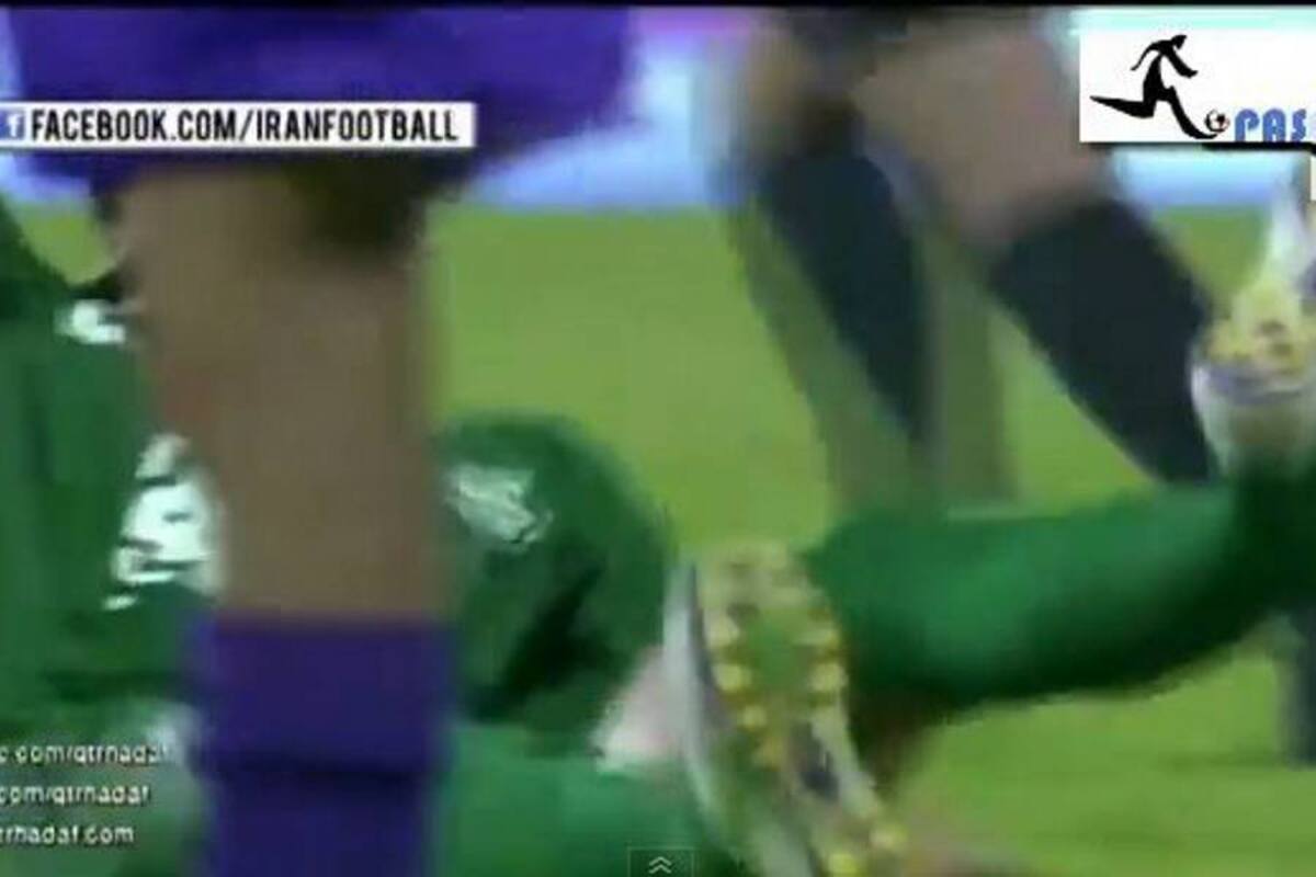 Jugador de fútbol sufrió impresionante lesión