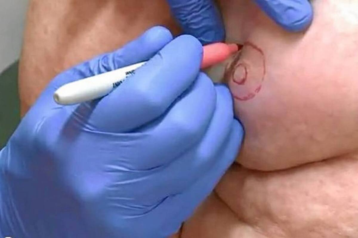 Tatuajes de pezón para mujeres operadas de cáncer de mama (Foto: Tomada de internet/VANGUARDIA LIBERAL)