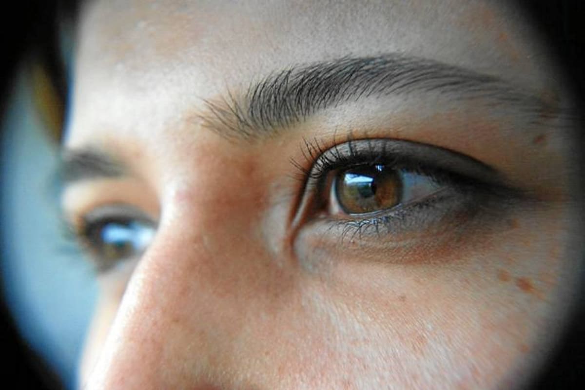 Glaucoma, la segunda causa de ceguera en el mundo (Foto: Tomada de internet/VANGUARDIA LIBERAL)
