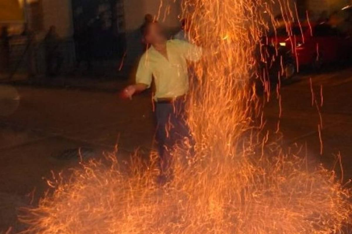 Van nueve quemados con pólvora en Santander (Foto: Archivo/VANGUARDIA LIBERAL)