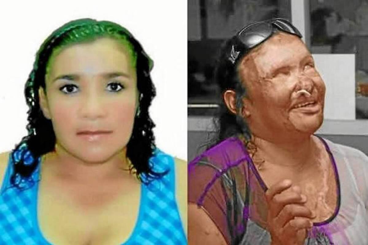 24 años de cárcel pagará autor intelectual de ataque a mujer con ácido en Girón (Foto: Archivo/VANGUARDIA LIBERAL)